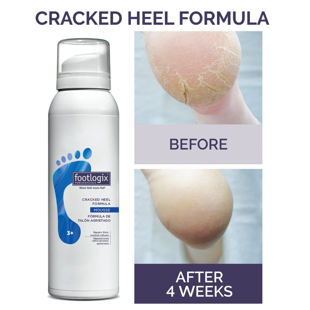 Footlogix Cracked Heel Mousse 125ml
