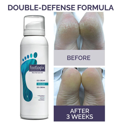 Footlogix DD Cream Mousse hydrating foot repair mousse for dry skin