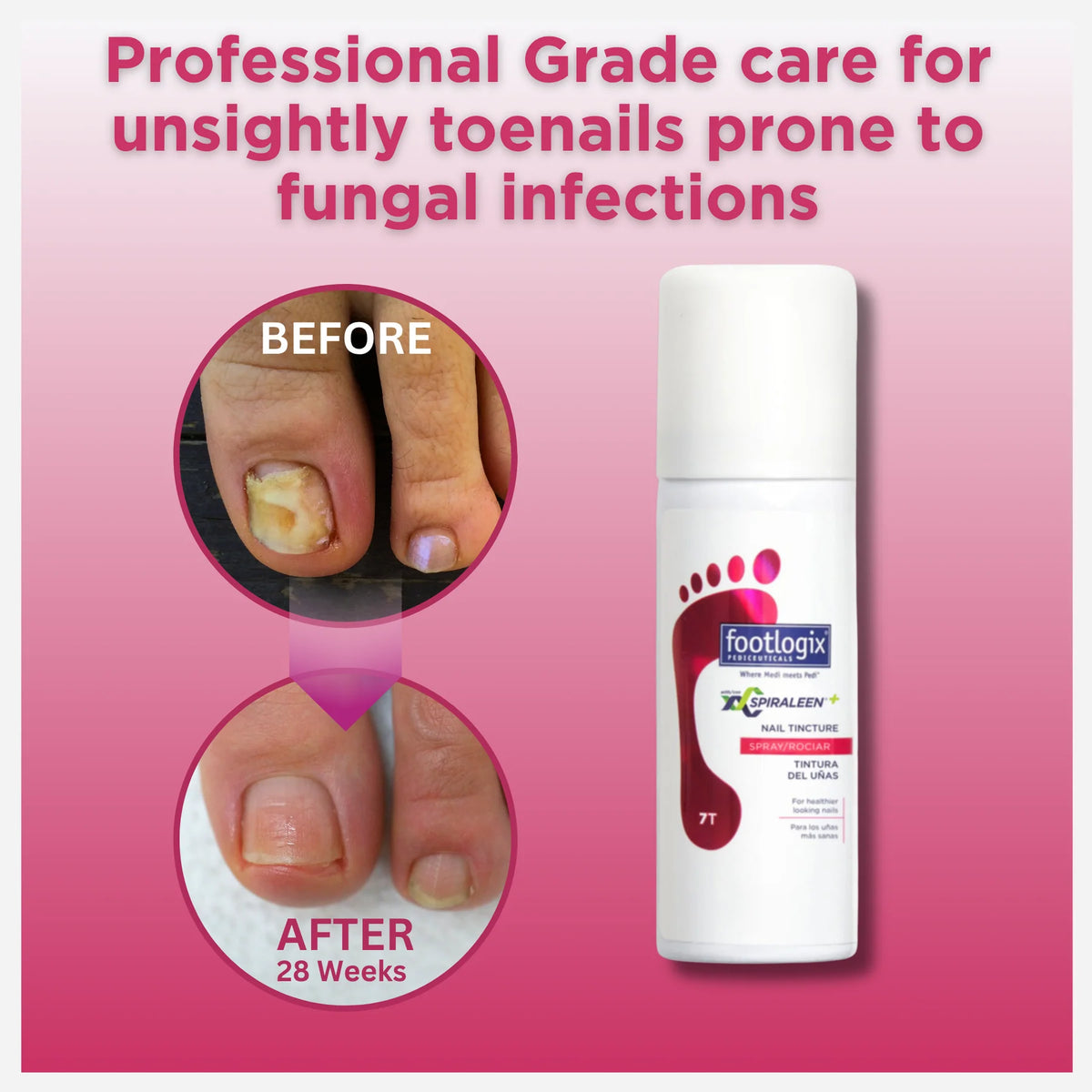 Footlogix Professional Nail Care Spray