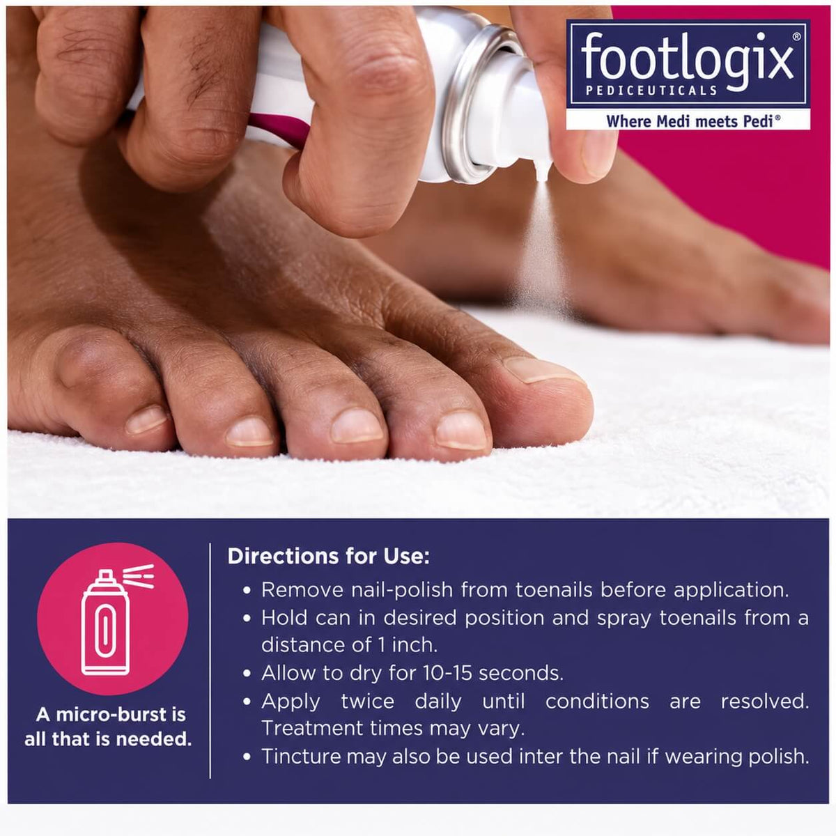 Footlogix Nail Treatment Spray 50ml